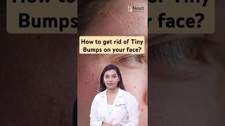 What is Milia on the face  How to treat milia  Dermatologist in Hyderabad [upl. by Inavihs]