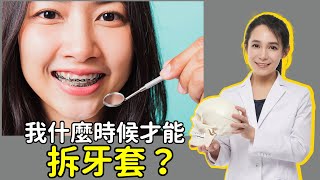 為什麼戴牙套矯正時間那麼長？拔牙矯正改骨性嘴凸最耗時，磨牙患者矯正時間長｜林榆芩醫師 [upl. by Flight634]