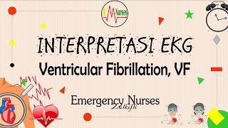 Ventricular Fibrillation VF [upl. by Acisseg]