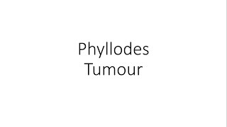 Phyllodes Tumour  Cystosarcoma Phyllodes  General Surgery [upl. by Oht]