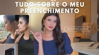 TUDO SOBRE MEU PREENCHIMENTO LABIAL E NO MENTO  BIOESTIMULADOR DE COLÁGENO RADIESSE [upl. by Weksler]