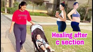 Healing process after c section  HINDI  WITH ENGLISH SUBTITLES  Debina Decodes [upl. by Ailad826]