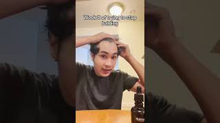 Time flys i feels like i started yesterday hairloss balding hairoil hairgrowth tiktokshop [upl. by Drofhsa757]