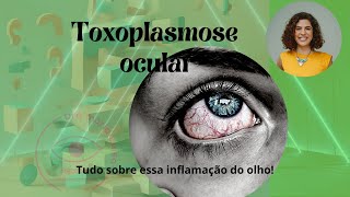 TOXOPLASMOSE OCULAR  Tudo que você precisa saber [upl. by Burl]