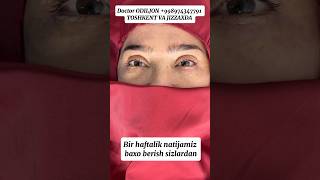 Qovoq olish  қовоқ олиш  blefaroplastika Doctor ODILJON 998974347791 TOSHKENT VA JIZZAXDA rek [upl. by Aniakudo]