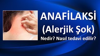 ANAFİLAKSİ NEDİR NASIL TEDAVİ EDİLİR [upl. by Ahsik]