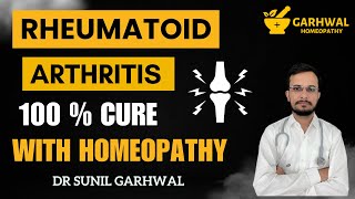 Rheumatoid Arthritis Homeopathy Treatment  Rheumatoid Arthritis Homeopathic Treatment in Hindi [upl. by Lusty]