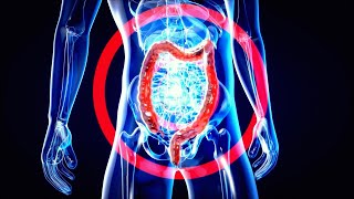 What Foods Promote ‘Good’ Gut Bacteria  Inside Health [upl. by Ho]