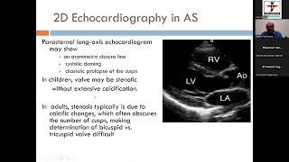 07 2024 06 21 20 45 13 Basics of Aortic stenosis Pul stenosis How to do it Dr Sameer Shrivastava [upl. by Kawai]