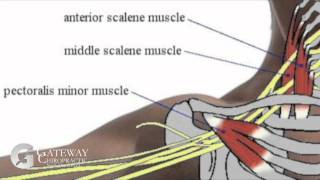 Gateway Minute Thoracic Outlet Syndrome TOS [upl. by Ayekram853]