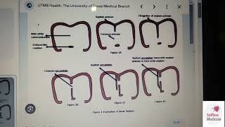 FCPS 1 CVS EMBRYOLOGY lecture 1 cardiac looping atrial septation [upl. by Nevi]