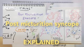 Post  Micturition Syncope Pathophysiology  Crosstalk [upl. by Netsoj]