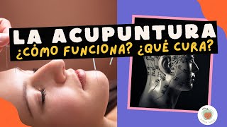 LA ACUPUNTURA Cómo Funciona  Qué cura [upl. by Jedd506]