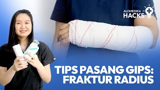 Tips Pasang Gips Fraktur Radius [upl. by Carny]