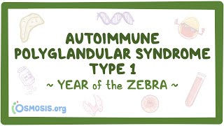 Autoimmune polyglandular syndrome type I  NORD Year of the Zebra [upl. by Onairam]