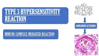 Type 03 Hypersensitivity Reaction  Made easy  Mechanism amp Examples  Images [upl. by Nilak]