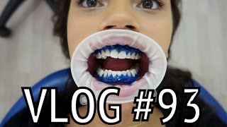 OMG BLAUWE TANDEN  MONICAGEUZENL VLOG 93 [upl. by Assyn217]