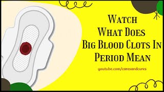 What Causes Blood Clots During Period  Blood Clots During Period  Large Blood Clots During Period [upl. by Halstead]