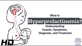 Hyperprolactinemia Unraveled The Root Causes Revealed [upl. by Gnay132]