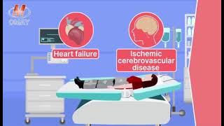 EECPa noninvasive and US FDA approved treatment for ischemic heart diseases [upl. by Yrebmik]