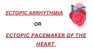 Ectopic pacemaker of heart  ectopic arrhythmia [upl. by Nolitta]