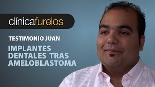 Juan Implantes dentales tras ameloblastoma [upl. by Hosfmann995]