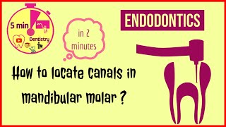 Mandibular first molar  access opening  Endodontics  RCT  easy tips [upl. by Reinar]