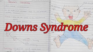 Downs Syndrome  Trisomy 21  Mongolism  Notes With Diagrams To Understand Better  Cx and Features [upl. by Aneer591]