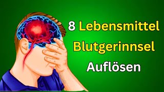 Die 8 besten Lebensmittel zur natürlichen Auflösung von Blutgerinnseln Gesunde Ernährungstipps [upl. by Brogle]