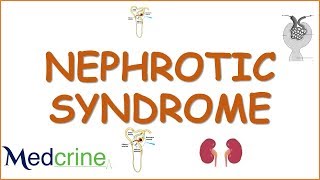 NEPHROTIC SYNDROME causespathophysiologydiagnosisfeatures and treatment [upl. by Enyar273]