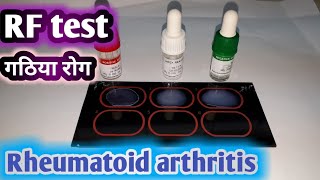 RF agglutination test  Rheumatoid arthritis test  गठिया रोग का जाँच और लक्षण । [upl. by Latrena]