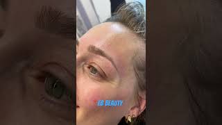 beauty cryolipolyse keşfet ebbeauty shortvideo beautysalon love viralvideo clinic [upl. by Jennifer949]