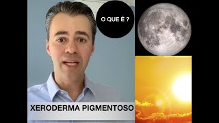 XERODERMA PIGMENTOSO doença que priva diariamente as pessoas do sol [upl. by Sabanrab446]