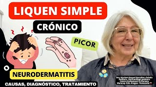 LIQUEN SIMPLE CRÓNICO o NEURODERMATITIS La piel pica se engrosa y mancha ​⁠depielapiel [upl. by Nnylimaj]