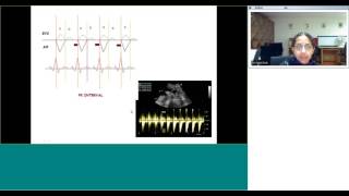 Fetal echo rhythm assessment by Dr Sejal Shah [upl. by Sidnarb]