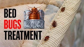 Bed Bugs Treatment  Khatmal Khatam Karne Ka Aasan Tarika  Pest Control Services Near Me  Kam Kaj [upl. by Eido985]