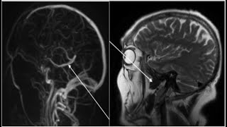 6ExamCNSRadiologyanatomy with answers FRCRCTMRIquestionsradiopediaradiologistquizzedtips [upl. by Ott]