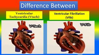 Difference Between Ventricular Tachycardia Vtach and Ventricular Fibrillation Vfib [upl. by Modla970]