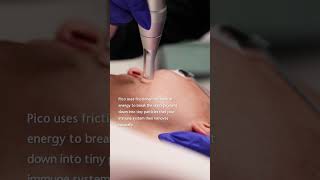 Skin Pigmentation Treatment with Pico Laser  Sydney [upl. by Irahc376]