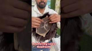 Best hair wigs shop in Kolkata Best hair patch centre for men’s Baldness solvehaircarespecialist [upl. by Arney]