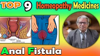 Anal Fistula Causes Symptoms and homeopathy Treatment  Dr P S Tiwari [upl. by Nunci]