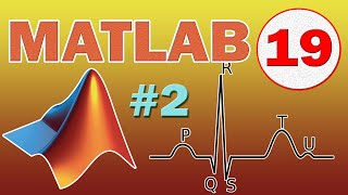 Matlab 19 Synthèse dun signal ECG Périodique  Peigne de Dirac TUTO [upl. by Hemminger]