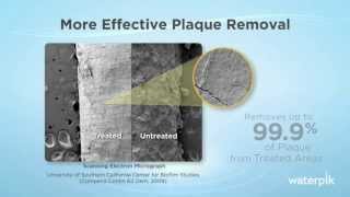 More Effective Plaque Removal  Independent Clinical Study [upl. by Neiviv]