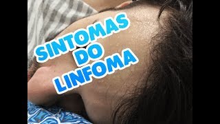 SINTOMAS DO LINFOMA [upl. by Harbed172]