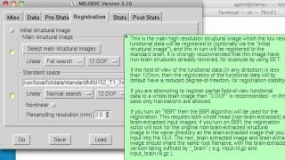 ICA Analysis Part IV GroupLevel ICA [upl. by Itsur]