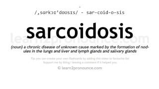 Sarcoidosis pronunciation and definition [upl. by Atilegna6]