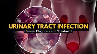 Urinary Tract Infection Causes Signs and Symptoms Diagnosis and Treatment [upl. by Springer583]