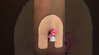 IV cannula insertiondocternursingmotivationviralvideoshortvideo [upl. by Jackelyn]