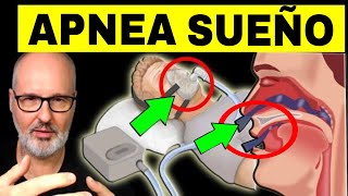 APNEA del SUEÑO Ronquidos y Somnolencia Causas Síntomas y Tratamiento [upl. by O'Brien]