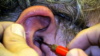 Chinese Auricular Electrical Diagnosis  Chinese Ear Acupuncture  Acupuncture CEU Online [upl. by Garner]